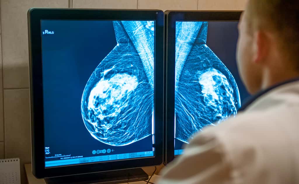 La mammographie est un examen efficace pour détecter les cancers du sein. © okrasiuk, Adobe Stock