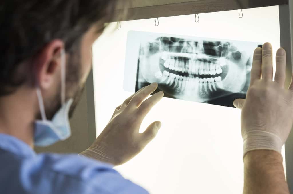 De nouvelles recherches montrent que la parodontite et l'augmentation du risque de développer certains cancers pourraient être liées. © Ridofranz, Istock.com