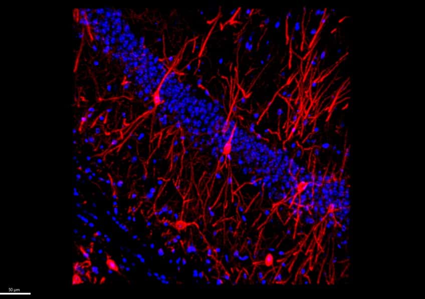 Image illustrant l’augmentation neuronale du récepteur A2A (en rouge) dans l’hippocampe de souris. On observe en bleu les noyaux de cellules (marqueur DAPI). © Émilie Faivre