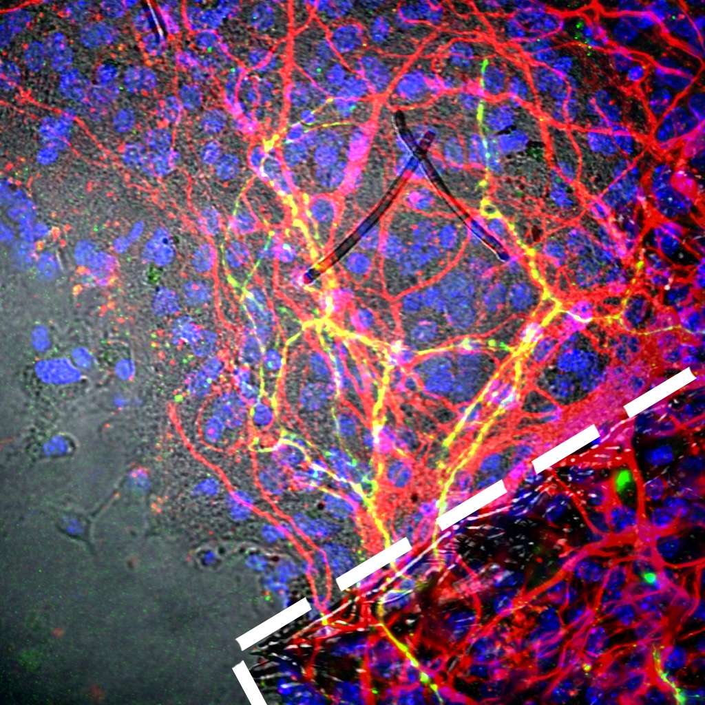 Les neurones humains (dans la ligne blanche) ont été greffés dans un tissu cérébral (en rouge). Ils se sont étendus (lignes jaunes) et se sont bien intégrés. © Neal K. Bennett, <em>Rutgers Biomedical Engineering</em>