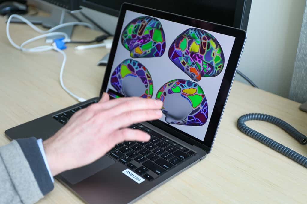Une étude menée par l’université de la Santé et des Sciences de l’Oregon a utilisé la neuro-imagerie pour confirmer les effets étendus du TDAH sur le cerveau. © OHSU, Christine Torres Hicks
