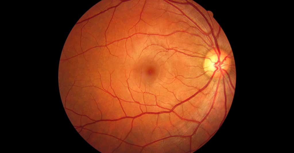 Dans le fond de l'œil, un médecin peut observer, entre autres, le disque optique (point où partent les vaisseaux et le nerf optique). © <em>Left-Handed Photography</em>, Shutterstock