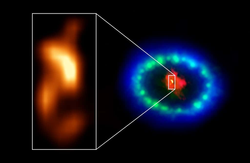  Des images Alma à très haute résolution ont révélé un « globule » chaud dans le noyau poussiéreux du reste de la supernova SN 1987A (encart), qui pourrait être l'emplacement de l'étoile à neutrons manquante. La couleur rouge montre de la poussière et du gaz froid au centre du reste de supernova, pris à des longueurs d'onde radio avec Alma. Les teintes vertes et bleues révèlent l'endroit où l'onde de choc en expansion de l'étoile explosée entre en collision avec un anneau de matière autour de la supernova. Le vert représente la lueur de la lumière visible, capturée par le télescope spatial Hubble de la Nasa. La couleur bleue révèle le gaz le plus chaud et est basée sur les données du télescope spatial à rayons X Chandra de la Nasa. © Alma (ESO, NAOJ, NRAO), P. Cigan et R. Indebetouw ; NRAO, AUI, NSF, B. Saxton ; Nasa, ESA  