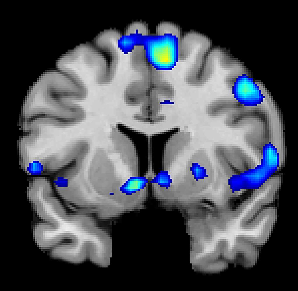 L’IRM fonctionnelle montre les régions du cerveau actives quand les participants font l’expérience de la spiritualité. © Jeffrey Anderson