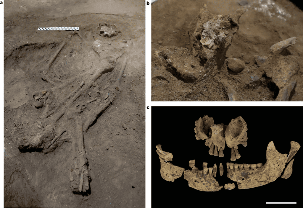 Le squelette inhumé en Indonésie, amputé du pied et de la cheville gauche. © Maloney, T.R., Dilkes-Hall, I.E., Vlok, M. et <em>al., Nature</em> (2022).