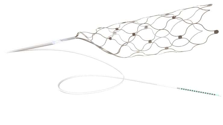 Les électrodes de Stentrode, qui forment un stent inséré par la jugulaire jusqu’à une veine dans le cerveau. © Synchron