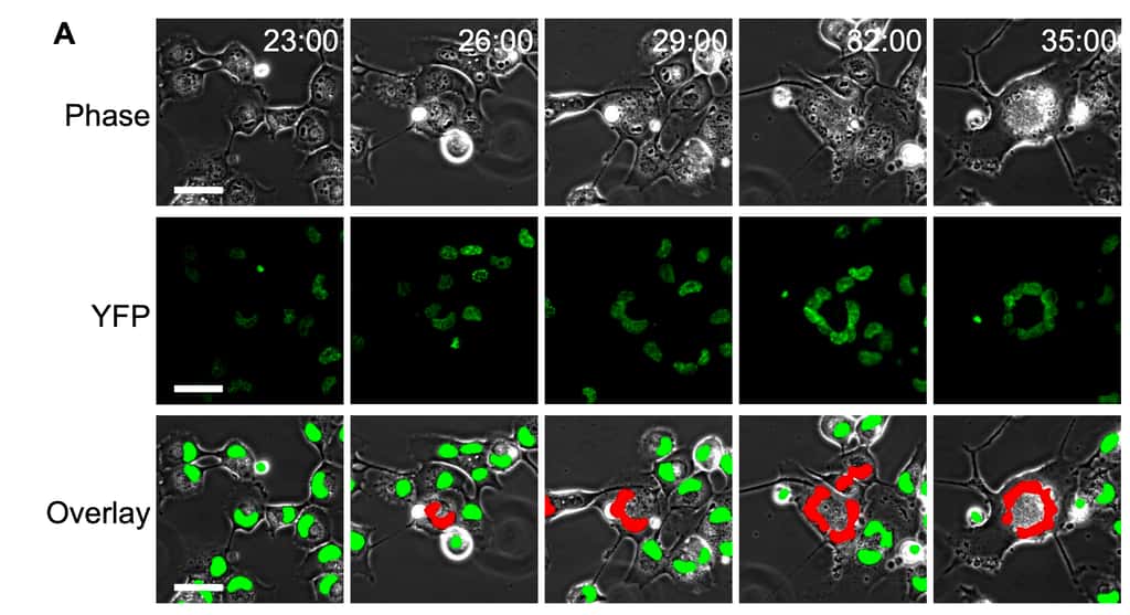  Le time-lapse qui suit la formation d'un syncitium au microscope. Les noyaux des cellules sont en vert, les formes rouges montrent la disposition en anneau caractéristique du syncitium provoqué par le SARS-CoV-2. © Laurelle Jackson et <em>al., BiorXiv</em>