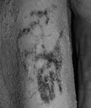 Tatouages identifiés sur le haut du bras du sujet masculin. Le dessin du haut représenterait un mouflon à manchettes et celui du dessous, un taureau sauvage. © British Museum