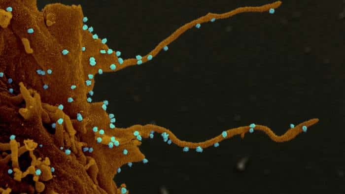 Sur cette image prise au microscope électronique, on voit la cellule de culture en orange ainsi que les longs tentacules recouverts de virions en bleu. © Elizabeth Fischer, NIH