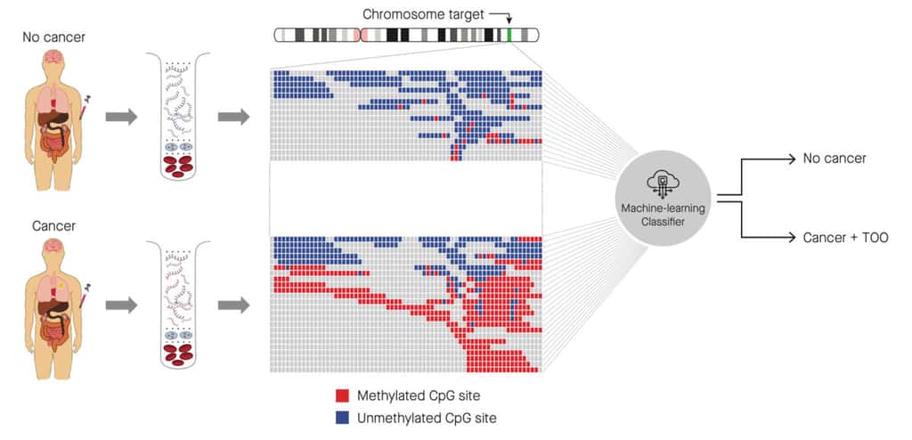 Le test de dépistage basé sur le <em>machine learning</em>. L'algorithme compare les sites méthylés sur de l'ADN circulant, produit par les cancers. Selon le profil des méthylations, il classe l'échantillon en deux catégories : cancéreux (avec détermination du tissu d'origine) ou non cancéreux. © M. C. Liu et al, <em>Annals of Oncology</em>