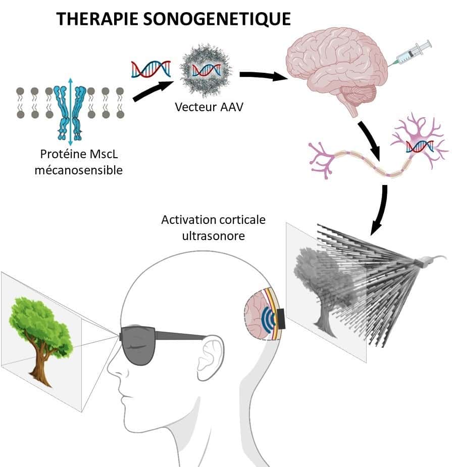  La thérapie sonogénétique consiste à modifier génétiquement certains neurones afin de pouvoir les activer à distance par des ultrasons. © Mickael Tanter et Serge Picaud, Inserm