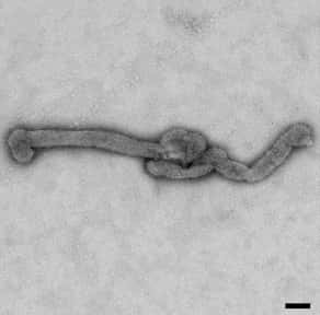 Le nouveau virus observé au microscope électronique. La barre représente 100 nm. © CDC, Kosoyet al., Emerging Infectious Diseases 2015