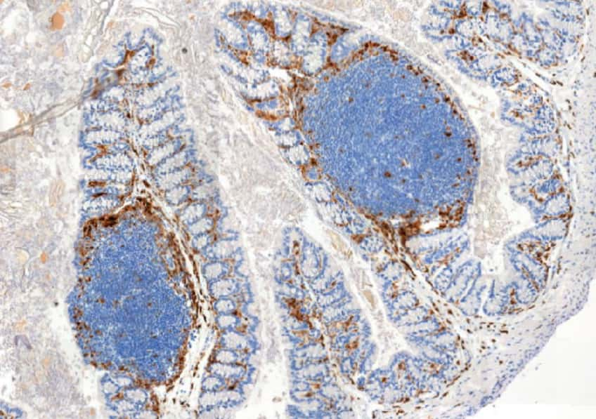 Coupe de tissu intestinal avec un marquage des cellules immunitaires. © Héloïse Rytter, Inserm