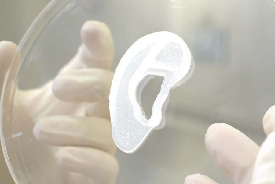  Un premier essai clinique est mené pour la reconstruction de l'oreille à l'aide d'un implant expérimental de tissu vivant bio-imprimé en 3D. © 3D Bio Therapeutic