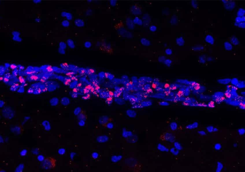 Image fluorescente d'un tissu cérébral humain post-mortem montrant des noyaux cellulaires (bleu) mettant en évidence un vaisseau sanguin dans lequel les cellules endothéliales vasculaires expriment le matériel génétique du SARS-CoV2 (rouge). © Vincent Prévot, Inserm