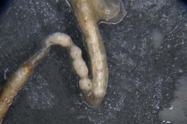 Polystyrène dans l'intestin d'un ver. © Université du Queensland