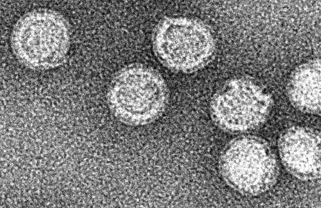 Le virus de l'encéphalite à tiques observé au microscope électronique. © Karin Stiasny, Christian Kössl, Jean Lepault, Félix A Rey, Franz X Heinz, CC by-sa 3.0 