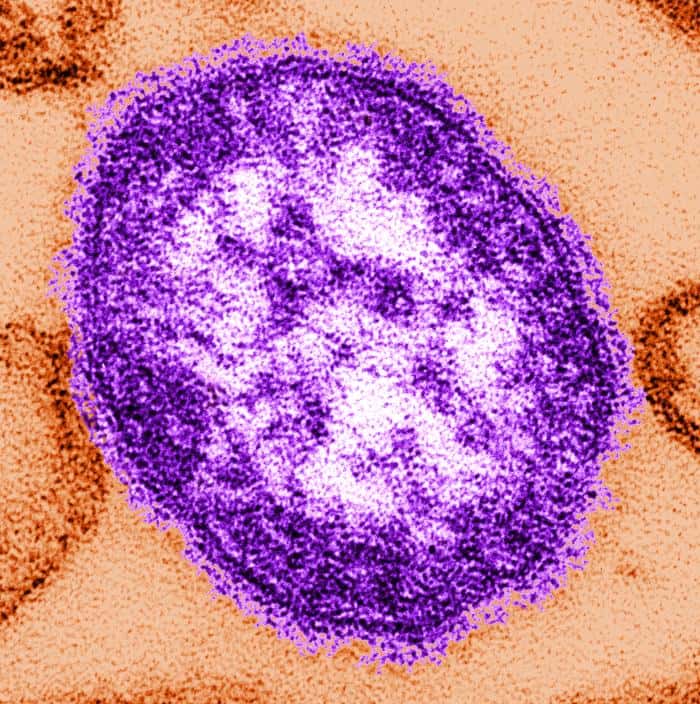Le virus de la rougeole vu au microscope électronique. © C. Goldsmith, W. Bellini, CDC