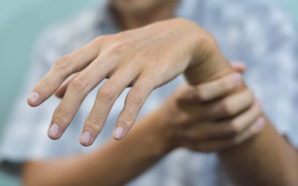 Le <em>wrist drop</em> est un symptôme typique d'une blessure au nerf radial. © ZayNyi, Adobe Stock