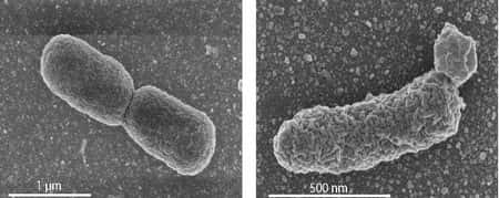 Des irrégularités sont observées au niveau de la membrane cellulaire des bactéries génétiquement modifiées (à droite), lorsque la production de lipides archéens est trop importante. À titre de comparaison, la membrane des bactéries <em>E. coli</em> normales (à gauche) est lisse. Les images sont obtenues au microscope électronique à balayage. © <em>University of Wageningen</em>/<em>Van der Oost Laboratory</em>