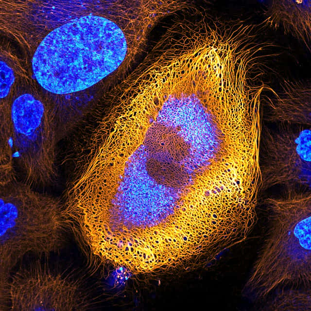 Une cellule de peau humaine et ses filaments de kératine grossis 40 fois. © Bram van den Broek, The Netherlands Cancer Institute