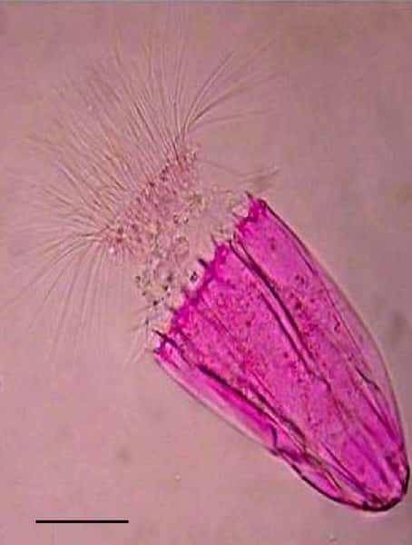 Le rose bengale est un colorant utilisé pour toutes sortes d'applications en recherche scientifique. Cette image montre un protozoaire (<em>Spinoloricus</em>) rosi par ce colorant. Ce produit a également des propriétés anticancéreuses. © Wikimedia Commons, Danovaro <em>et al.</em>, cc by 2.0