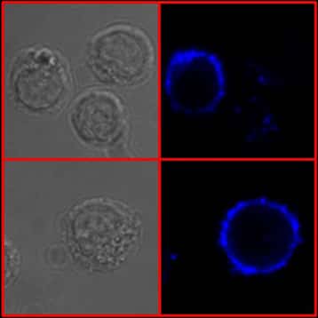 Internalisation des IgE membranaires (endocytose spontanée) contribuant à une expression faible de l’IgE et à la mort de ces cellules. Visualisation en microscopie confocale (x 1.000) de lymphocytes B IgE+ incubés à 37 °C avec des anticorps anti-IgE. Ce marquage permet de mettre en évidence un phénomène d’internalisation des IgE membranaires visualisées en bleu (droite). © CNRS, laboratoire « Contrôle de la réponse immune B et lymphoproliférations »