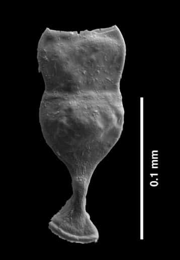 Spécimen malformé de chitinozoaire, un fossile de micro-zooplancton du Silurien du genre <em>Margachitina</em>. © Thijs Vandenbroucke