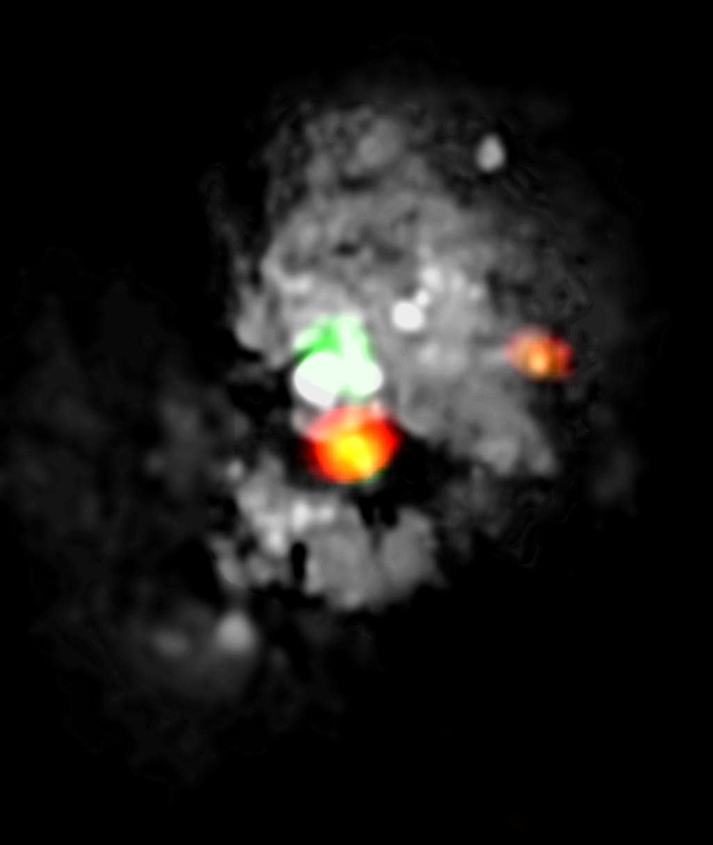 Grâce à l’observatoire Noema, les astronomes ont pu détecter une région de formation stellaire très active dans le « Medusa merger ». L’image multilongueur d’onde montre « l’œil de Méduse » (orange) qui se situe directement en dessous du trou noir au centre de NGC 4194 (blanc et vert ici). © Iram, Nasa, Esa, <em>Hubble Space Telescope, Hubble Legacy Archive</em>