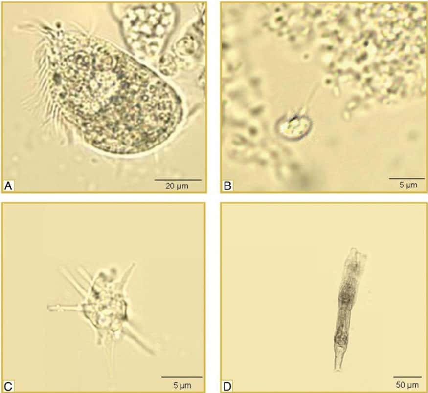 Photographie au microscope de différentes espèces d'eucaryotes trouvés dans la mine d'uranium de Königstein. © Zirnstein et <em>al.,</em> 2012, <em>Microbiology open</em>