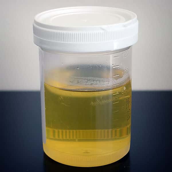 Les cellules présentes dans l'urine peuvent être utilisées pour fabriquer des dents. © Wikimedia Commons, DP