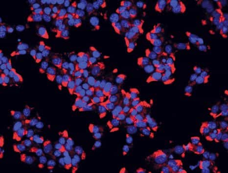 Les cellules bêta des îlots de Langerhans du pancréas sont celles qui produisent l’insuline. Lors d’un diabète de type 1 les cellules ß sont détruites par le système immunitaire. Dans cette étude, l’administration d’hippurate améliore l’équilibre glycémique et stimule la sécrétion d’insuline dans des modèles animaux. © Inserm/U845/UMRS975/EndoCells SARL