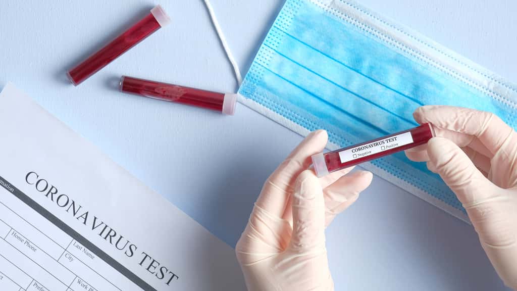 Les tests sérologiques peuvent être pratiqués par un professionnel de santé ou un pharmacien. © Photoguns, Adobe Stock