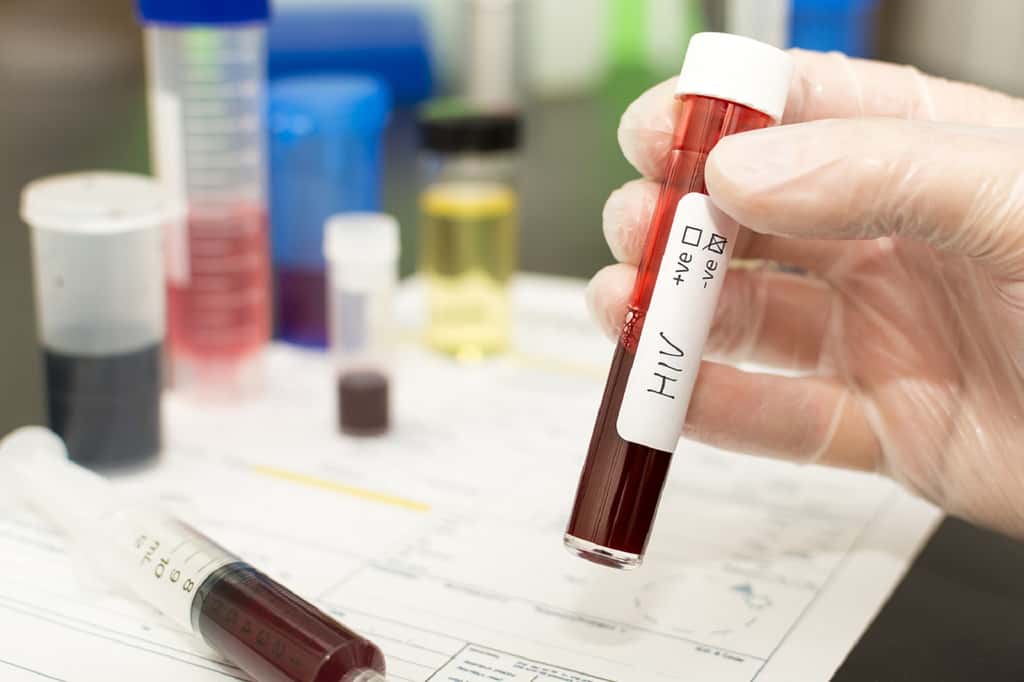 La résistance au VIH procurée par la mutation du gène TNPO3 a été découverte par les chercheurs en inoculant le virus à du sang issu de patients porteurs de la mutation. © mrtom-uk / IStock.com
