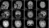 IRM d'un cerveau. © Delphotostock, Adobe Stock&nbsp;