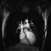 Au milieu de la poitrine, légèrement sur la gauche, le cœur est un organe central. Il pompe le sang à travers l'organisme pour irriguer tous les tissus et leur apporter de quoi fonctionner correctement. © IR4M – CNRS – Université Paris Sud