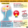 Il existe deux types d'accident vasculaire cérébral : l'AVC ischémique et l'AVC hémorragique. On en compte 1 toutes les 4 minutes en France. © idé