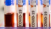 Coronavirus : on peut être infecté plusieurs fois de suite. © Nordicstocks, Adobe Stock