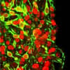 Les cellules souches sont aussi un espoir de traitement de la maladie de Parkinson. On voit ici des neurones nouvellement générés (en rouge) dont beaucoup sont devenus des neurones dopaminergiques (en vert), qui sont altérés chez les malades. © Lorenz Studer/Developmental Biology/Sloan-Kettering Institute