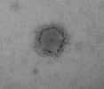 Le nouveau coronavirus NCoV, au microscope électronique. © Cynthia Goldsmith, Azaibi Tamin, CDC