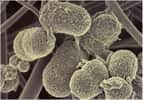 Prevotella intermedia est une des bactéries intestinales prépondérantes dans un des assemblages identifiés par les chercheurs. © DR
