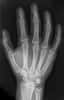Les rayons X sont une forme de rayonnement électromagnétique. L'énergie de ces photons va de quelques eV à plusieurs dizaines de MeV. Ils ont de nombreuses applications dans l'imagerie médicale (radiographie conventionnelle) et la cristallographie. Mais ils permettent également de détecter la présence d'os sur des tissus fossilisés. © Hellerhoff, Wikipédia, cc by sa 3.0
