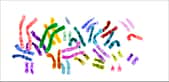 Normalement, nous sommes tous équipés de chromosomes regroupés en paires. Mais les trisomiques disposent d'un trio de chromosomes 21, ce qui entraîne un certain nombre de symptômes, que les scientifiques pensent prochainement pouvoir limiter. © NIH, Wikipédia, DP