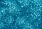 Les cellules souches embryonnaires constituent l’un des outils majeurs de la médecine régénérative, qui sera probablement en mesure de réparer les organes malades, voire d’en faire pousser intégralement en laboratoire. Désormais, les scientifiques savent les obtenir à partir de cellules de la peau par des techniques de clonage thérapeutique. © Eugene Russo, Plos One, cc by 2.5