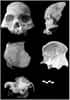 Fragments de crâne trouvés dans une grotte près du village de Longlin en Chine. Ils datent d'une époque marquant la transition entre le Pléistocène et l'Holocène. La barre d'échelle représente 1 cm. © Darren Curnoe et al. 2012, Plos One