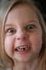 Le bisphénol A et d'autres perturbateurs endocriniens pourraient être à l'origine d'une maladie des dents récemment décrite chez les enfants, appelée MIH. Celle-ci se caractérise par des taches blanches causées par une hypominéralisation, rendant les dents plus sensibles à la douleur et plus susceptibles aux caries. © Foamcow, Flickr, cc by nc nd 2.0