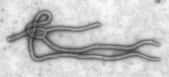 Le virus Ebola (ici vu au microscope électronique) possède une forme filamenteuse, d'où son appartenance à la famille des Filoviridés. Crédits DR