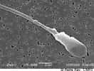 La globozoocéphalie spermatique est caractérisée par la présence d'une tête ronde chez les spermatozoïdes. © Pierre Ray, CNRS