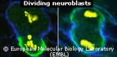 Neuroblastes en division :à gauche division asymétrique normaleà droite perte d'asymétrie conduisant à une prolifération tumorale