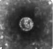 Image en microscopie électronique du virus du Nil occidental.